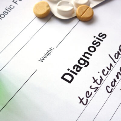 Testicular cancer – Causes, types, symptoms, and treatment
