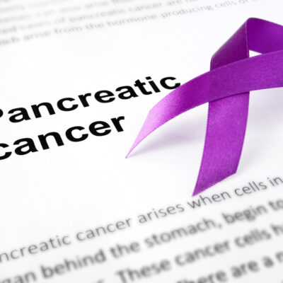 Causes and risk factors of pancreatic cancer