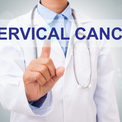 A guide to understanding cervical cancer