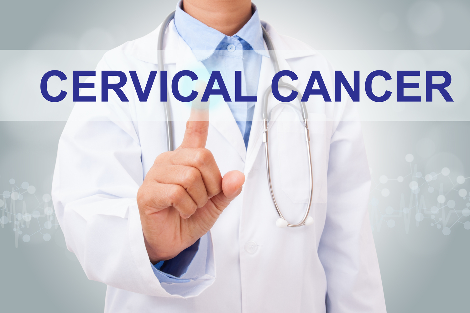 A guide to understanding cervical cancer