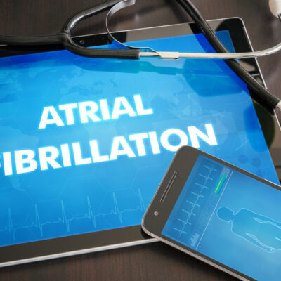 Natural Treatments for Atrial Fibrillation
