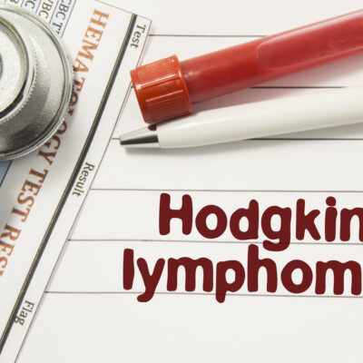 Causes and symptoms of Hodgkin’s disease