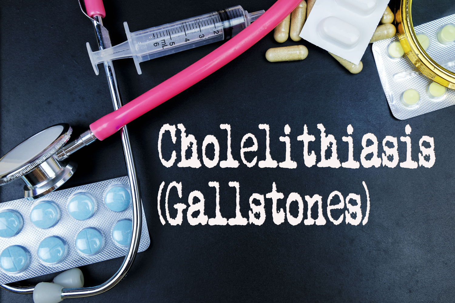 The causes, symptoms, and treatment for gallstones