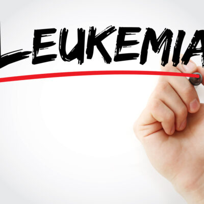 Causes and symptoms of leukemia