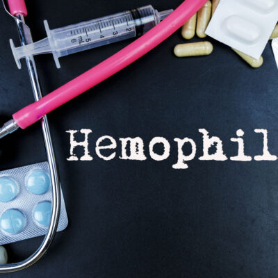 Hemophilia and its causes