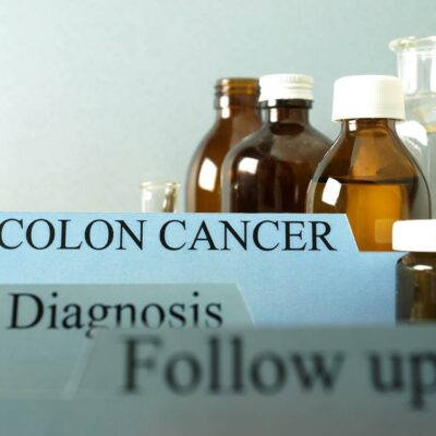 Causes and risk factors of colon cancer