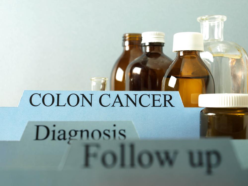 Causes and risk factors of colon cancer