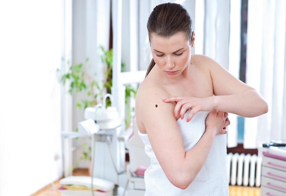 The stages of melanoma and the treatment options