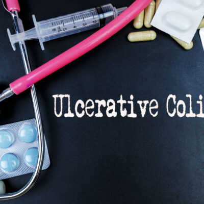 Foods to Avoid for Colitis